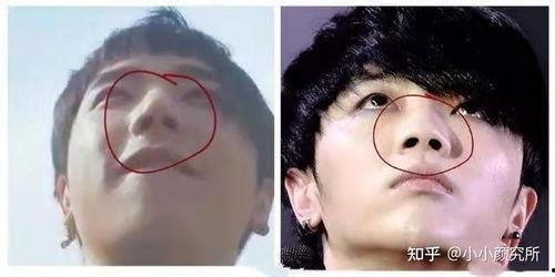 华晨宇整容后照片,蜕变之路，颜值飙升